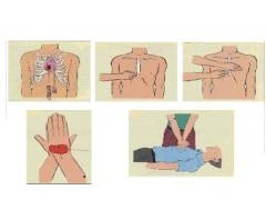 毒蛇咬傷的急救